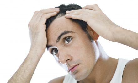 Stai perdendo troppi capelli? – Telogen effluvium?