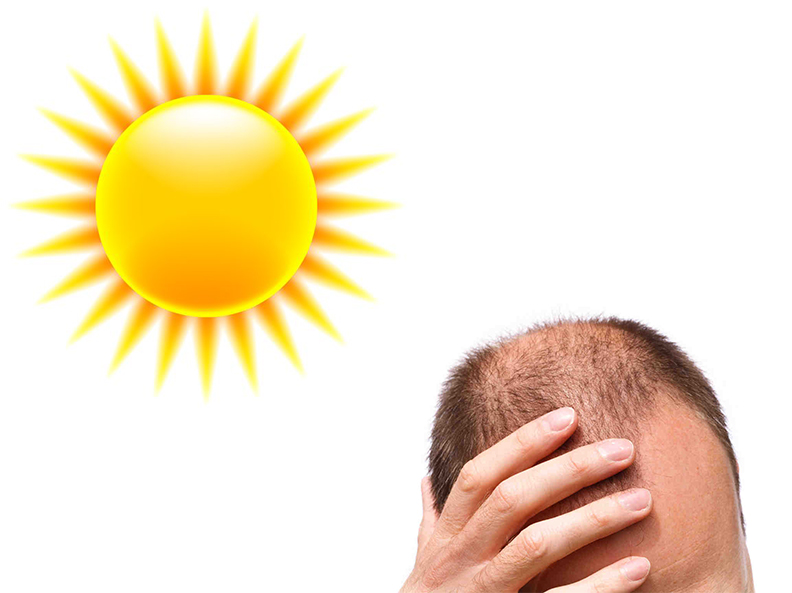 La caduta dei capelli aumenta in estate?