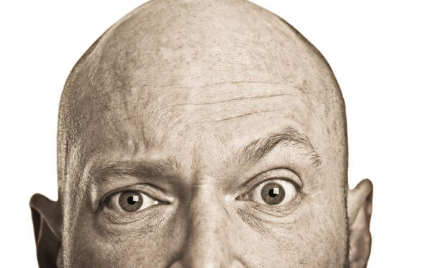 La caduta dei capelli: defluvio,affluvio e alopecia