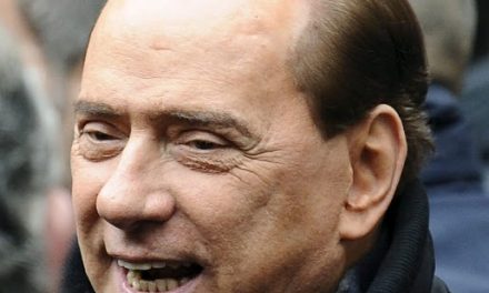 Berlusconi e il trapianto di capelli