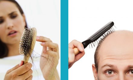 Caduta capelli – differenza tra uomo e donna