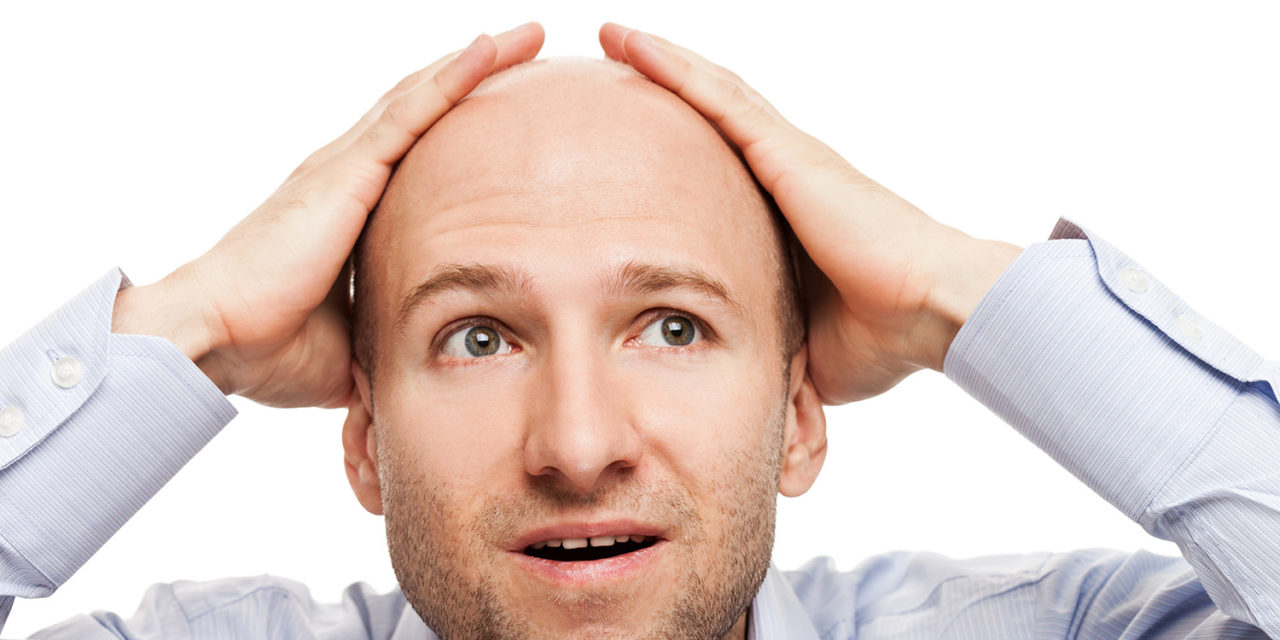 L’alopecia – quando si può fare il trapianto?