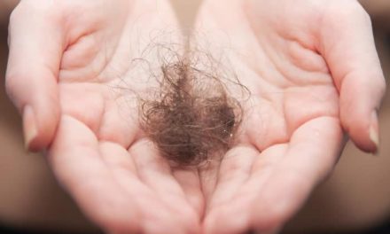 Alopecia Iatrogena – farmaci che fanno cadere i capelli
