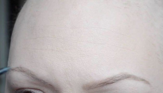 Chemioterapia e perdita dei capelli