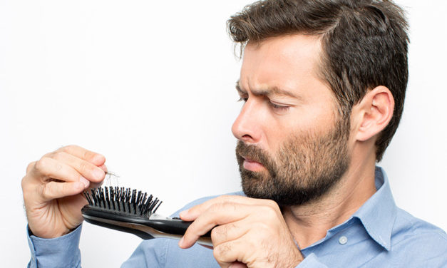 Perché gli uomini perdono i capelli?