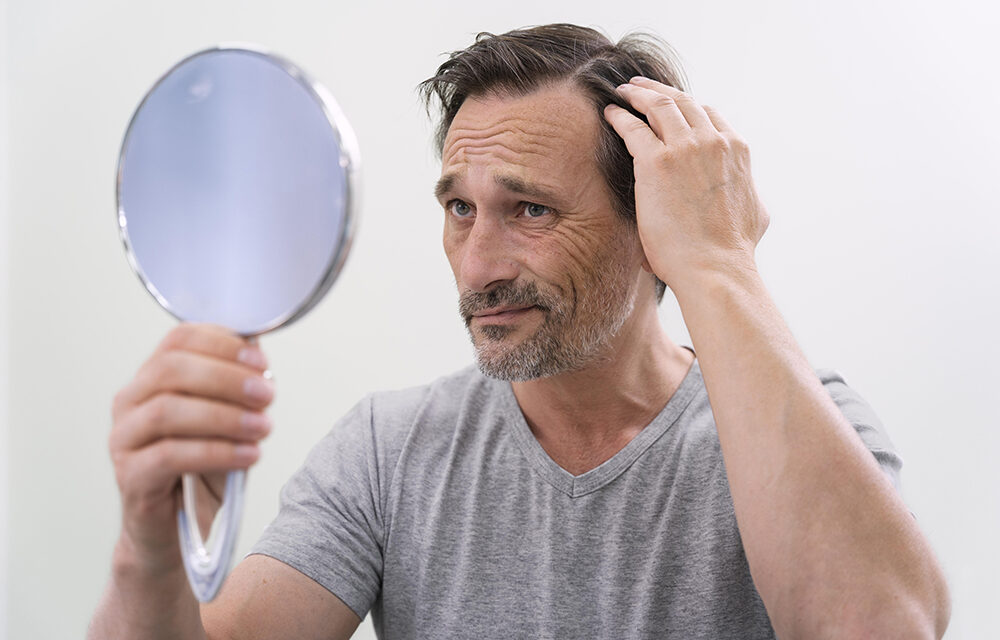 Quanto dura il trapianto di capelli?