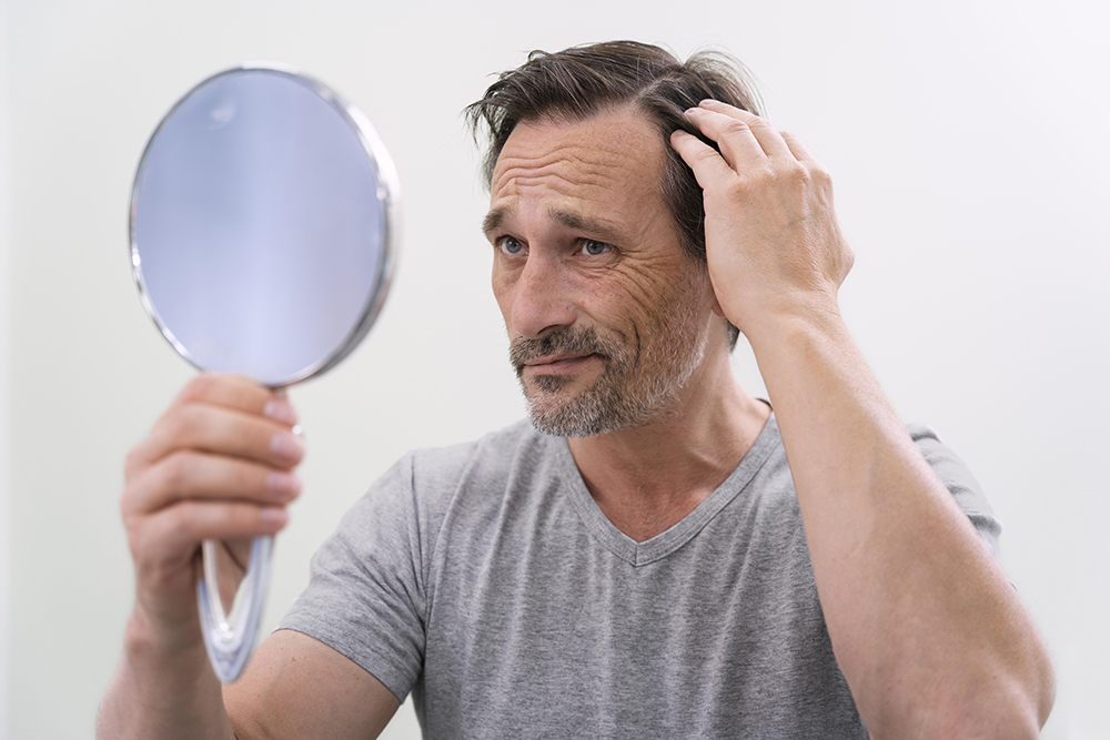 Quanto dura il trapianto di capelli?