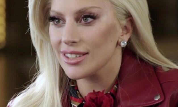Lady Gaga e l’alopecia